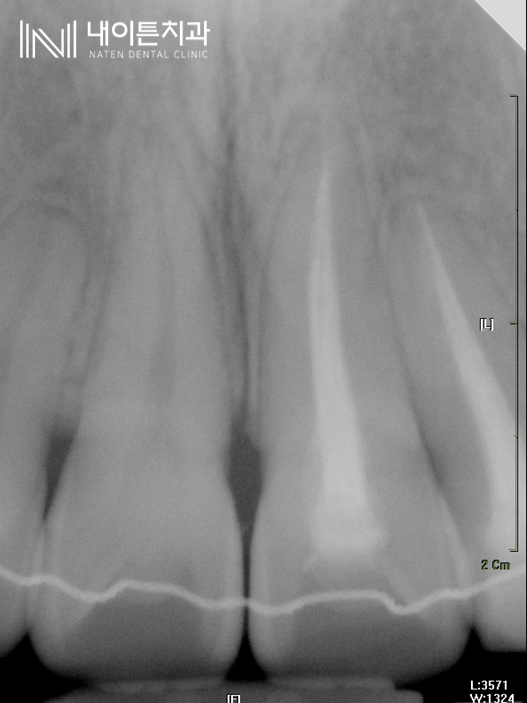 Treatment case image 2