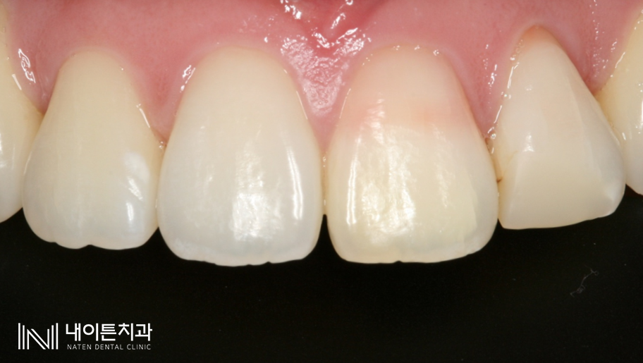 Treatment case image 7