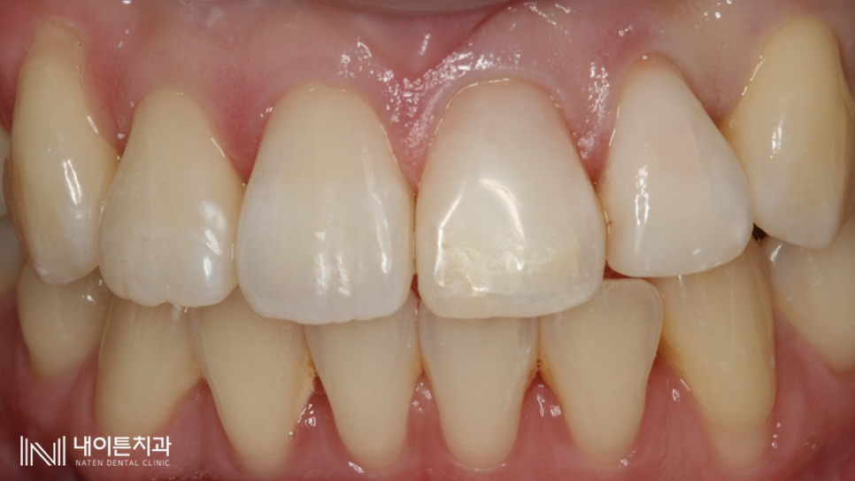 Treatment case image 8