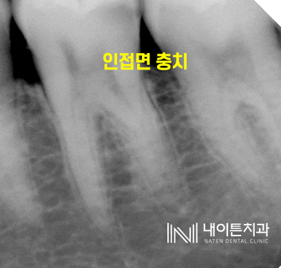 Treatment case image 1