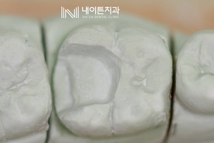 Treatment case image 6