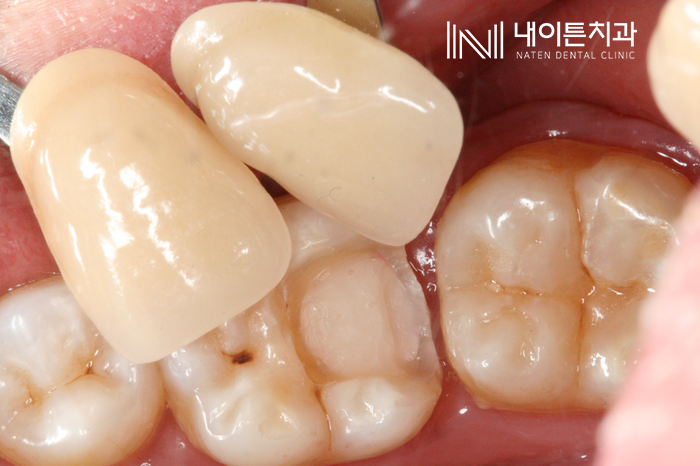 Treatment case image 7