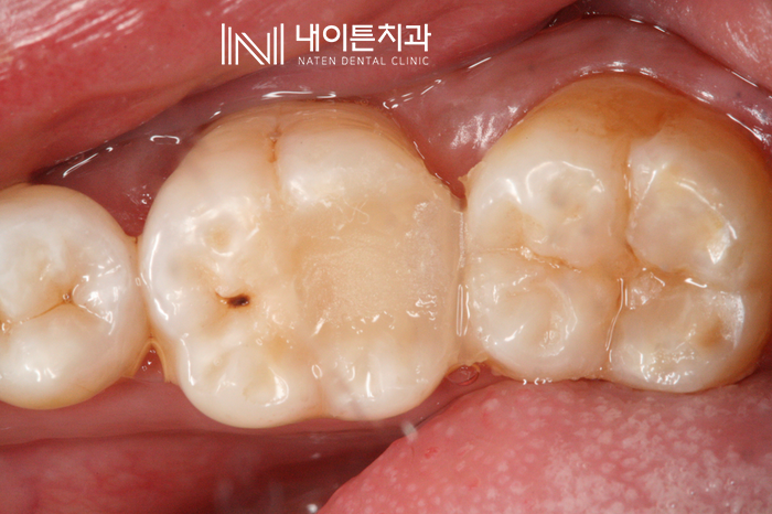 Treatment case image 8