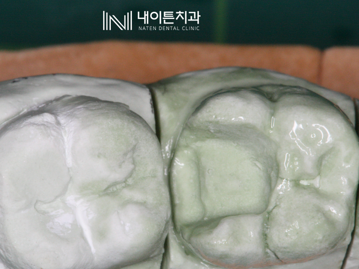 Treatment case image 9