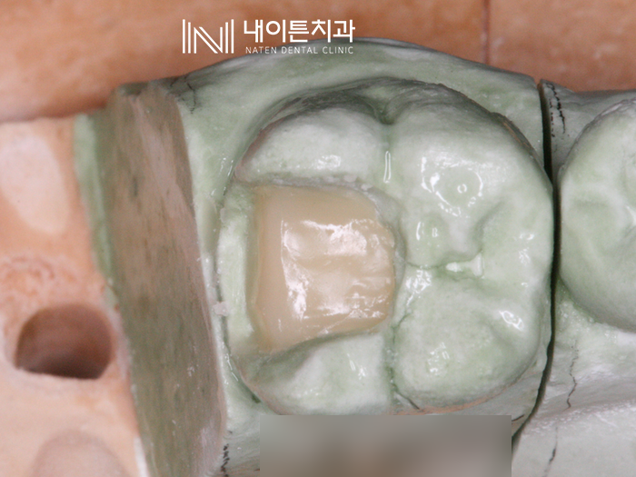 Treatment case image 10