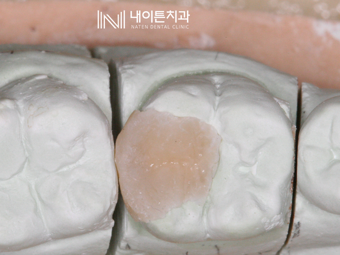 Treatment case image 11