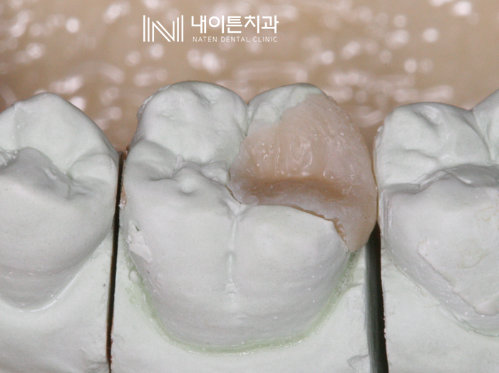 Treatment case image 12