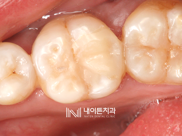 Treatment case image 17