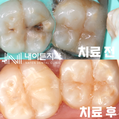 Treatment case image 18