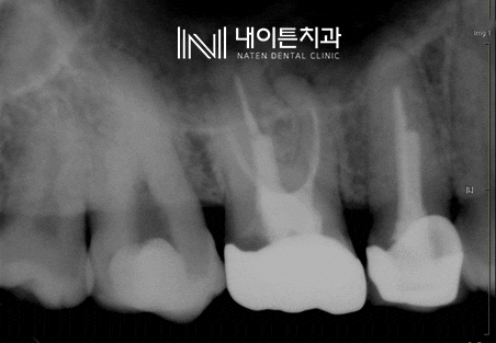 Treatment case image 1