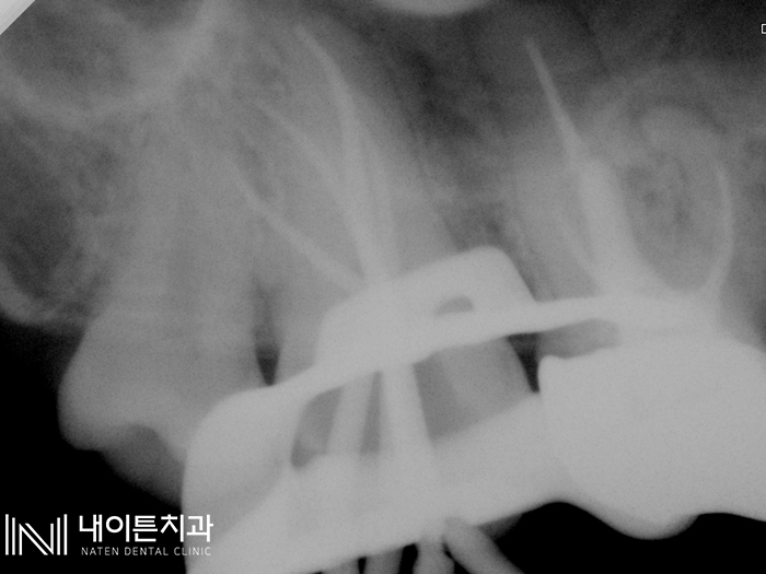 Treatment case image 5