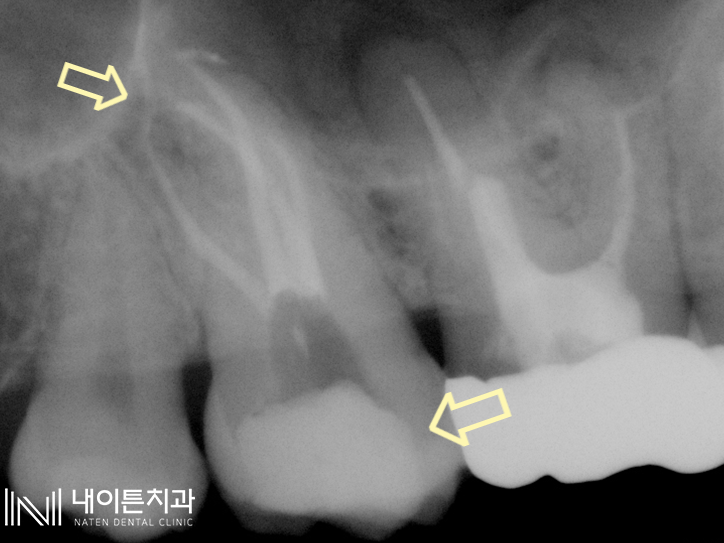 Treatment case image 6