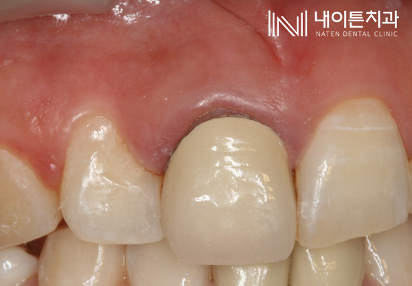 Treatment case image 1