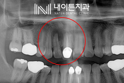 Treatment case image 3