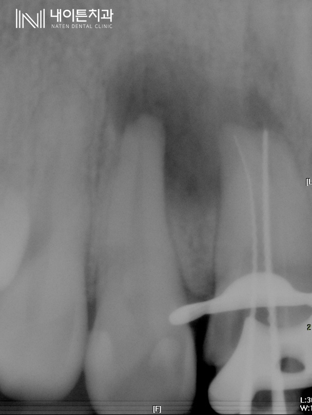 Treatment case image 4