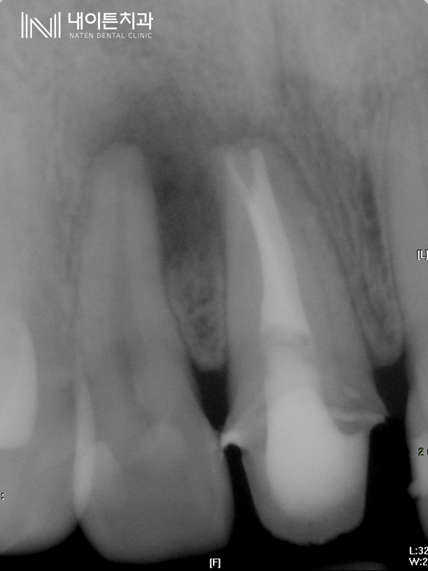Treatment case image 7