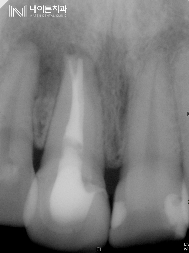 Treatment case image 8