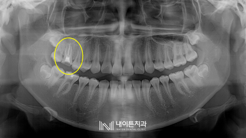 Treatment case image 1
