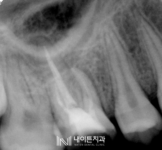 Treatment case image 2