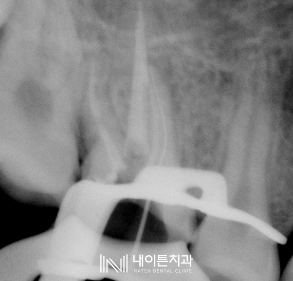 Treatment case image 7