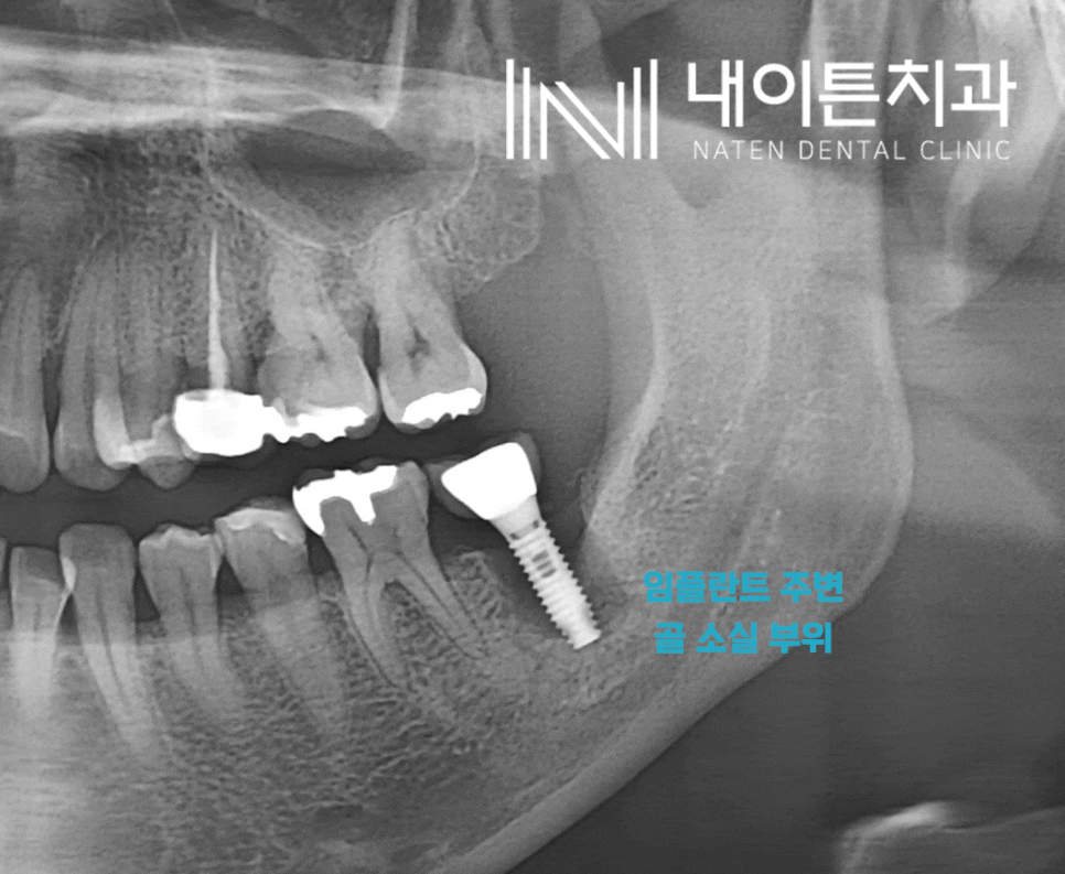 Treatment case image 1