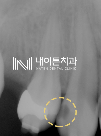 Treatment case image 1