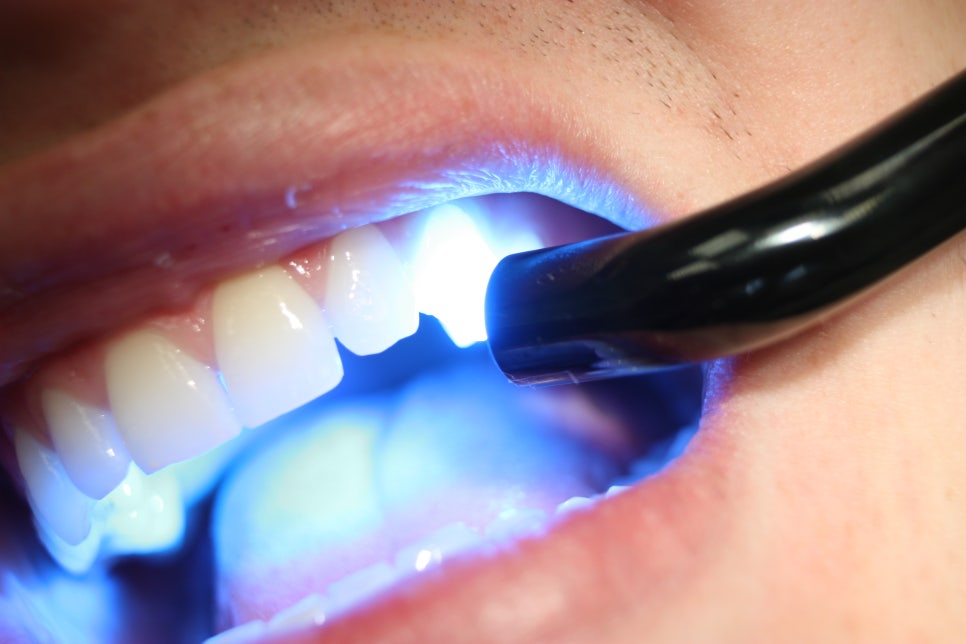 Treatment case image 5