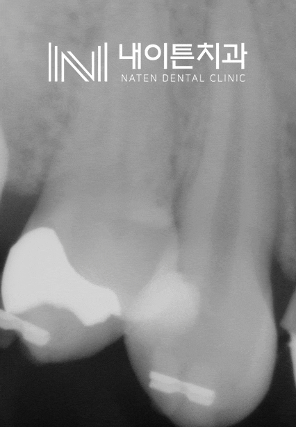 Treatment case image 8