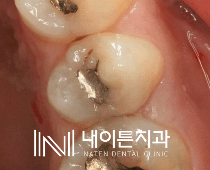 Treatment case image 1