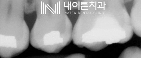 Treatment case image 2