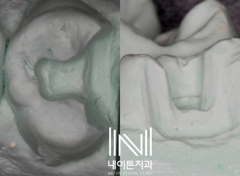 Treatment case image 5
