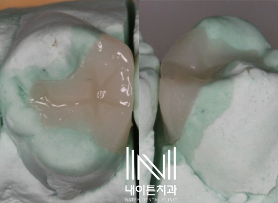 Treatment case image 6