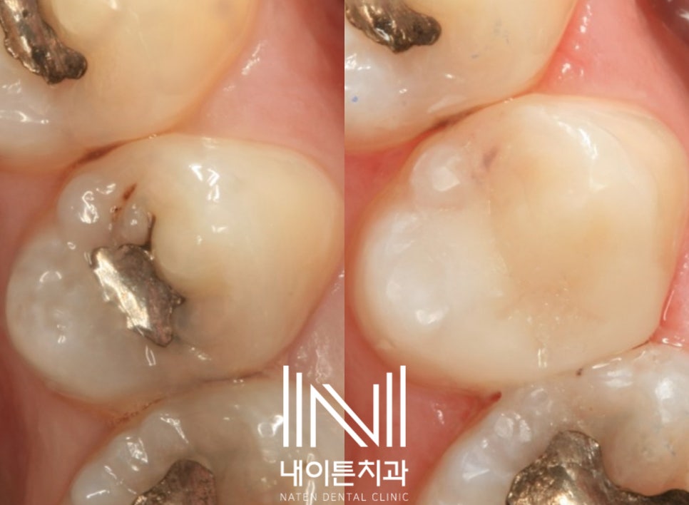 Treatment case image 9