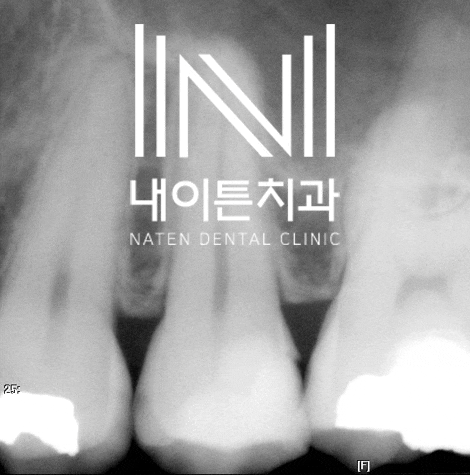 Treatment case image 10