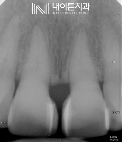 Treatment case image 1