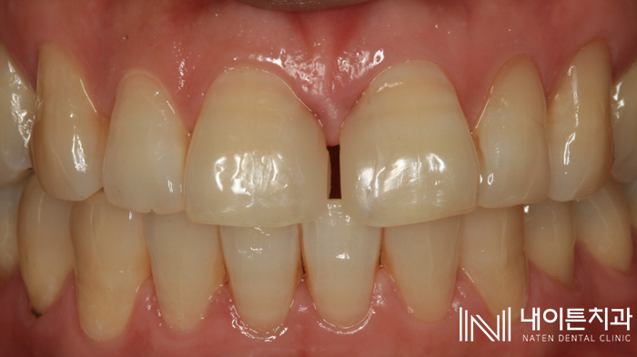 Treatment case image 2