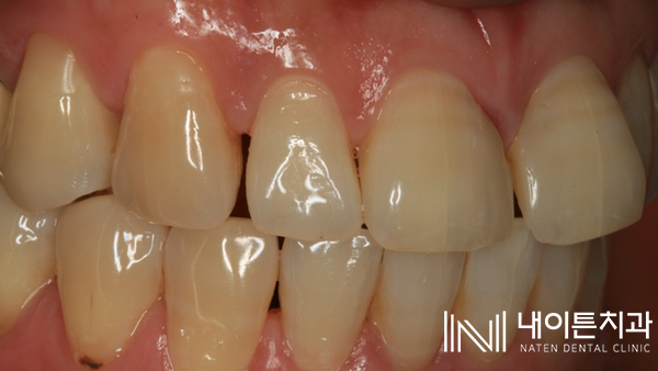 Treatment case image 3