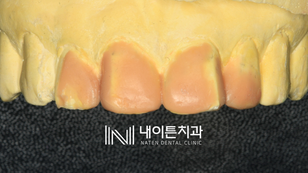 Treatment case image 9