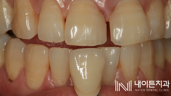 Treatment case image 10