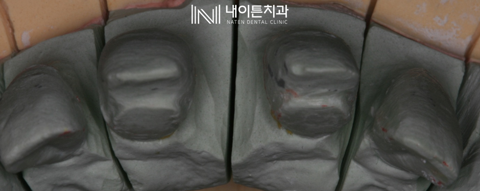 Treatment case image 11