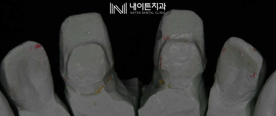 Treatment case image 12