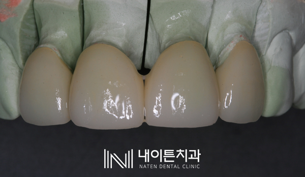 Treatment case image 13
