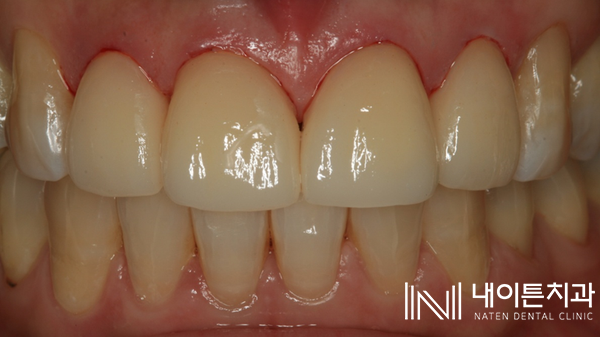 Treatment case image 21