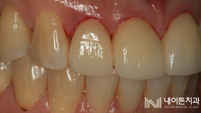 Treatment case image 22