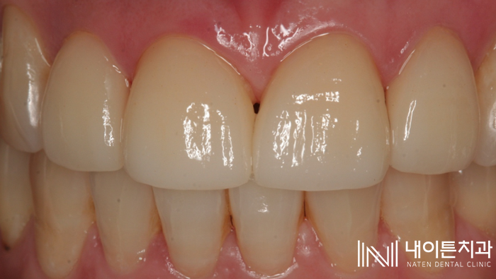 Treatment case image 25