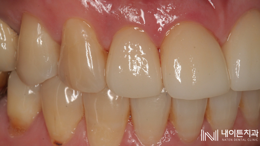 Treatment case image 26