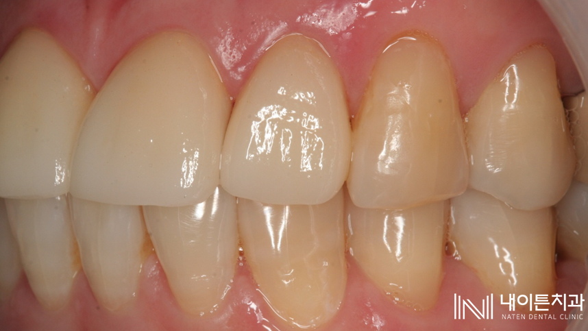 Treatment case image 27