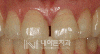 Treatment case image 18