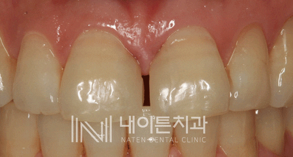Treatment case image 28
