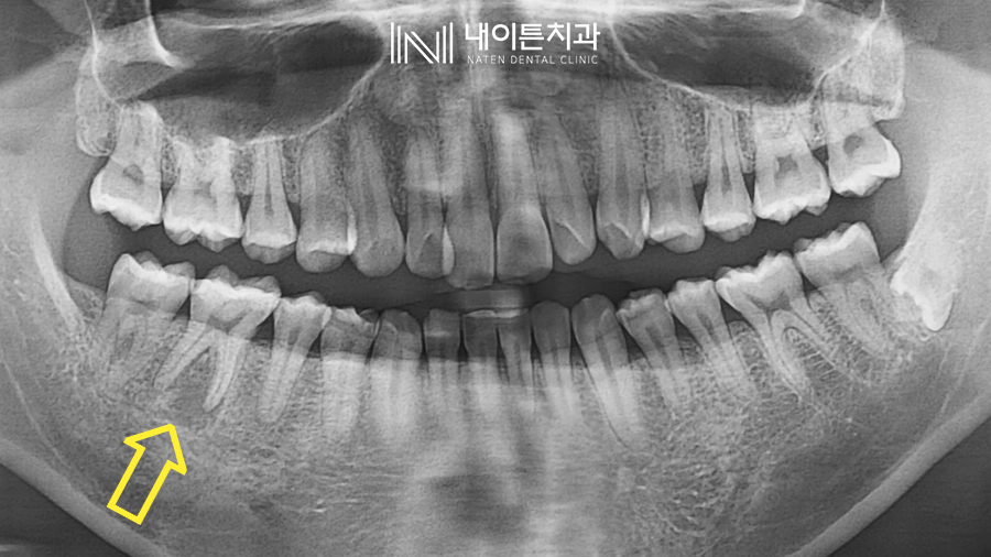 Treatment case image 2